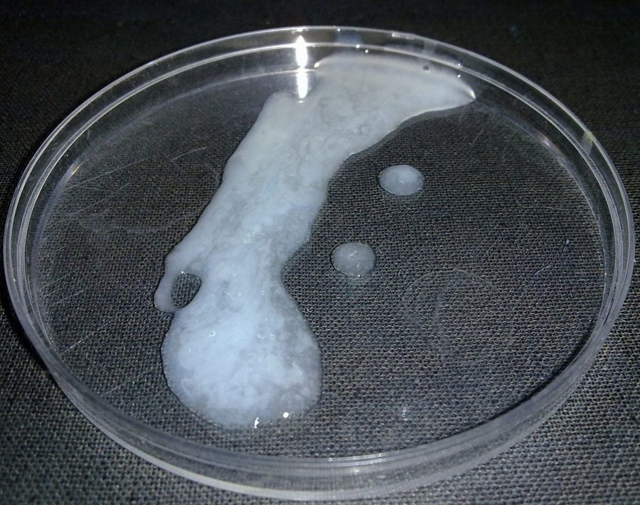 Tinh trùng vón cục là hạt trắng nhỏ như hạt cơm, bóp mịn như bột